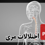 دانلود پاورپوینت اختلالات مری Esophagus + اقدامات پرستاری